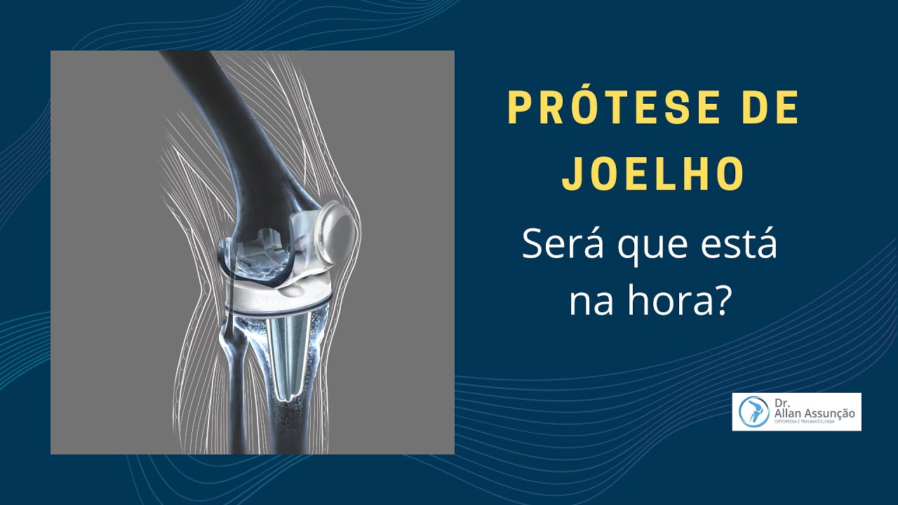 Será que a hora de colocar prótese no joelho é agora?