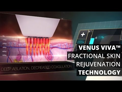 Venus Viva™ Fractional Skin Rejuvenation Technology
