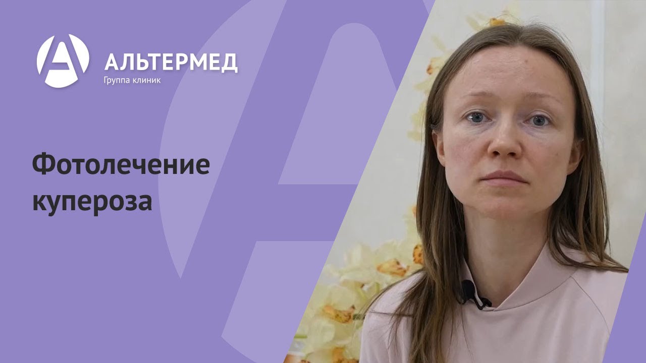 Купероз на лице: причины и лечение, как бороться и избавиться от купероза