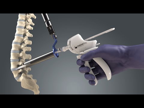 Introducing MagnetOs MIS