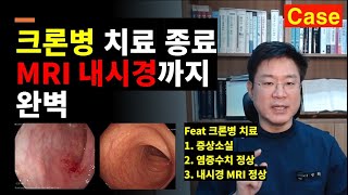 면역억제제, 평생 먹어야 하나요?