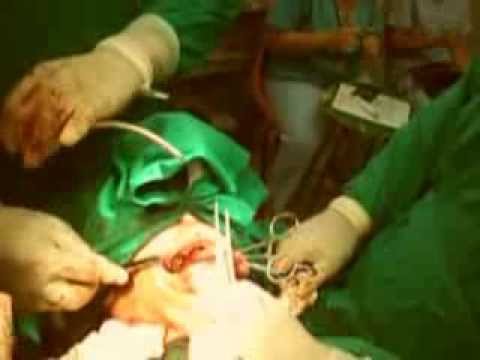 CRONICAS DE UN VIAJE Videos tomados de la operacion realizada al salmista cubano Danilo Ramirez