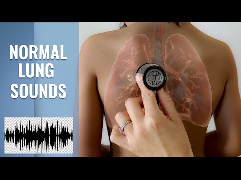 Name that NORMAL Lung Sound? Normal Lung Sounds: Bronchial, Bronchovesicular & Vesicular sounds