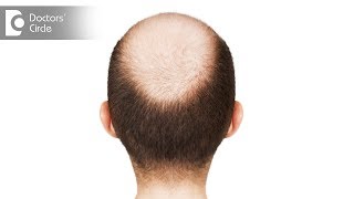 Causes of thinning of hair and baldness in the centre of head - Dr. Amee Daxini