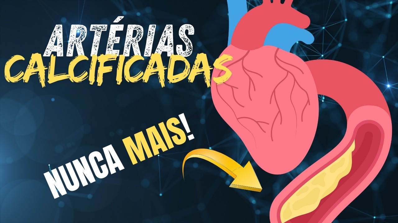 SUPLEMENTOS e ALIMENTOS para LIMPAR AS ARTÉRIAS CALFICICADAS (ATEROSCLEROSE)