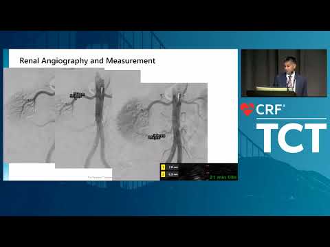The Next Wave of Hypertension Management : Ultrasound RDN Technology and Clinical Evidence