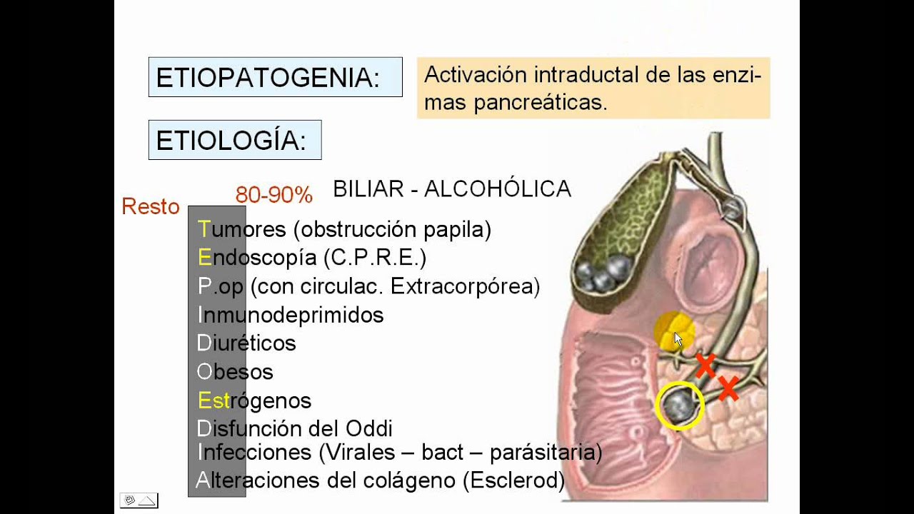 Pancreatitis