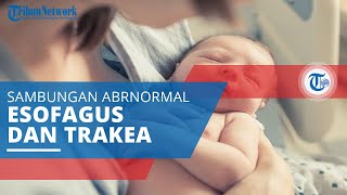 Fistula Trakea Esofagus, Kondisi Sambungan Abnormal (Fistula) di Antara Esofagus dan Trakea
