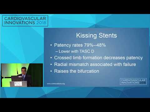 CVI2018 Session: Using endografts to treat occlusive aortoiliac disease - Magdiel Trinidad, MD