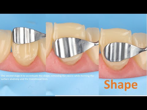 Composite bonding as simple as possible