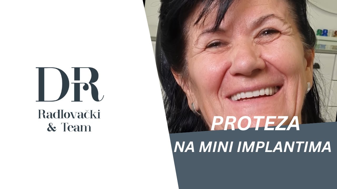 Video iskustvo pacijenta — proteza na mini implantima (1)