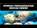 Operasi Pengangkatan Minyak Kemiri