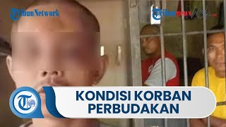 Kondisi Korban Dugaan di Rumah Bupati Langkat, Penuh Lebam dan Berkaca-kaca saat Ditemukan