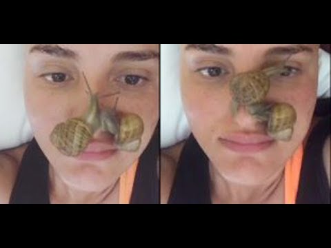 Buccia di faccia ultrasonica da posti di pigmentary La crema con lazione di decolorazione per comprare achroactive max in