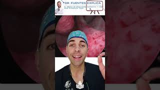 Otorrinolaringología: Diente ectópico