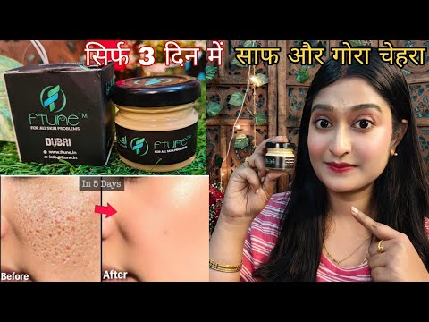 FTune Whitening Cream Honest Review ✨ | indigenous beauty