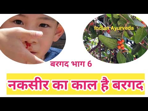नकसीर यानी नाक से खून बहने का इलाज | naksir rokne ke upay in hindi | nakseer ka ilaj | nose bleeding Video