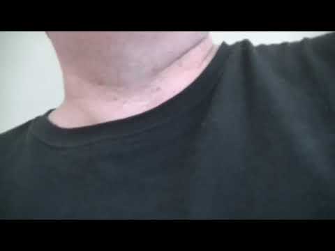 MongoTV_6544 - JOHN LÆSER - Del 100 - McCORD Nr.15 - Del 4 - Snigskytten