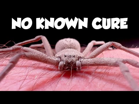 THIS is the Worst Spider Bite on Earth - The Six-Eyed Sand Spider