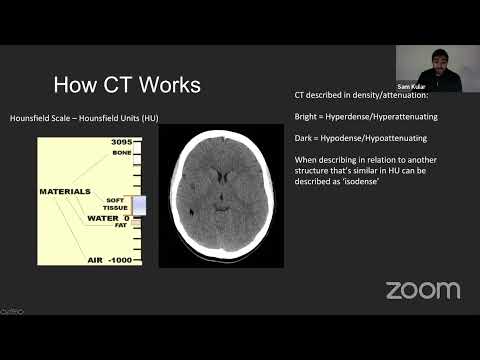 CT head Interpretation