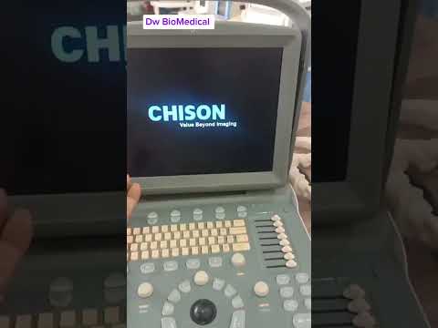 chison portable ultrasound machine model echo 1