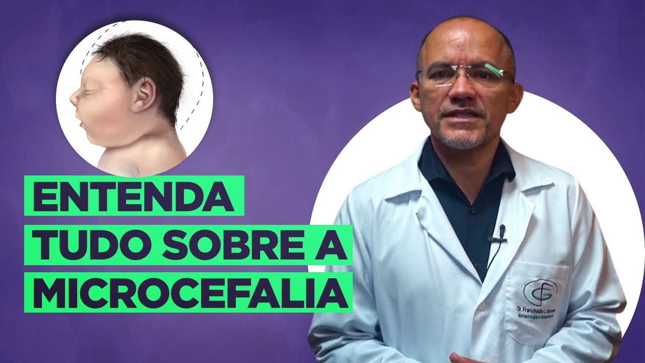 Microcefalia: Neurocirurgião Explica Tudo Sobre a Doença!