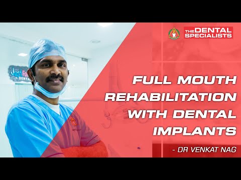 Full Mouth Dental Implants In Hyderabad | Full Mouth Dental Implants Cost in Hyderabad | TDS