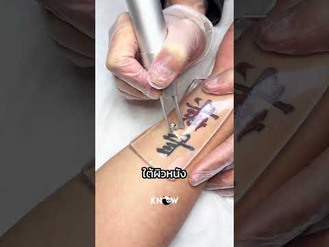 แผ่นซิลิโคลนที่เปลี่ยนวงการลบรอบสัก