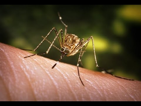 Delaminazione della cartilagine nellarticolazione del ginocchio Torcicollo sul lato destro