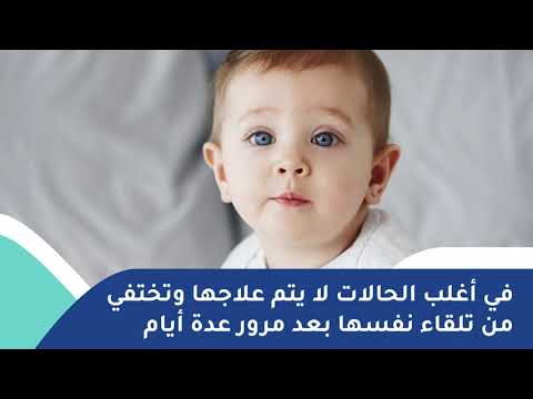 لماذا تظهر حبوب على وجه الرضيع؟