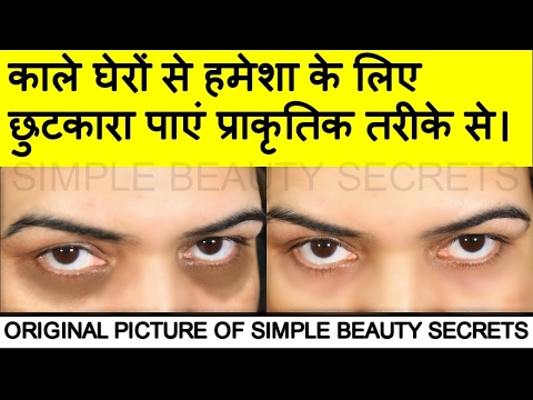 How To Get Rid Of Dark Circles In 3 Days (काले घेरे) By Simple Beauty Secrets Video