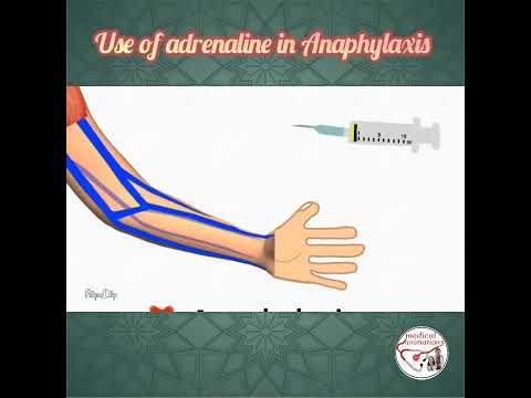💉 HOW TO USE ADRENALINE (EPINEPHRINE) IN ANAPHYLAXIS ? #pediatrics  #medicine #epinephrine
