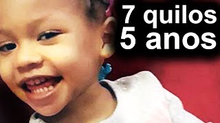 7 kg aos 5 anos: o caso perturbador de Cali Anderson