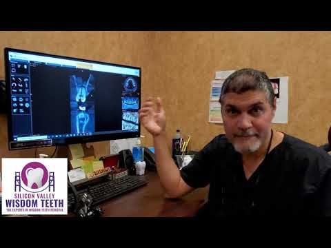 Fear of dentists and it's consequences