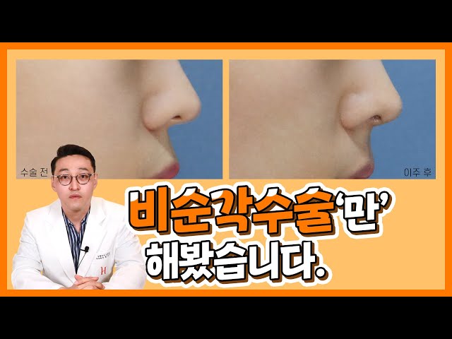 히트성형외과 - 나만의 아름다움! _코성형_히트 3D프린팅 코성형 히트성형외과 - 나만의 아름다움! _코성형_히트 3D프린팅 코성형