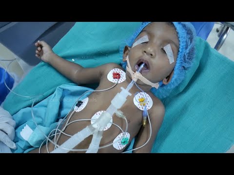 Pediatric Anesthesia Intubation For Child