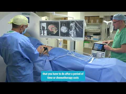 CAS-One IR System - Welcome to the tumour treatment revolution