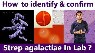How to identify & Confirm Streptococcus agalactiae