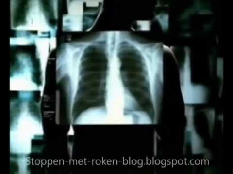 Stoppen Met Roken Blog - Roken & Je longen