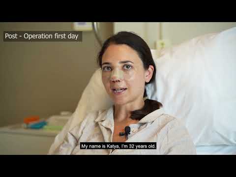 Ribcartilage Closed Third Revision Rhinoplasty ( Op. Dr. Tolga Oğuzhan )