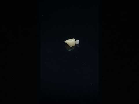 YouTube 썸네일