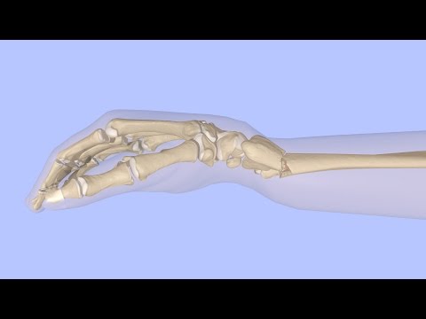 Réduction fermée d'une fracture du radius distal