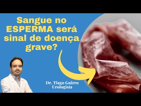 Is blood in semen a sign of serious illness? Urologist Dr. Tiago Guirro