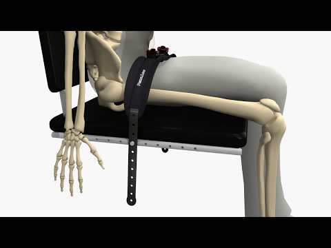 A2J Pelvi.Loc Animation 3DSR Reverso