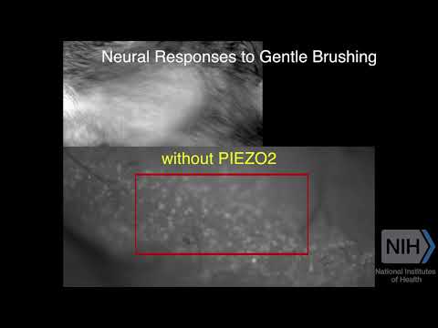 A Gene for Painful Touch