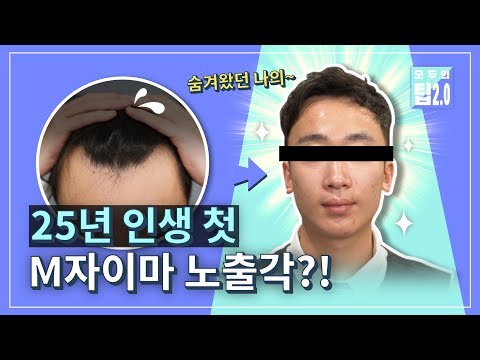 25년 인생 첫 M자이마 노출각?!