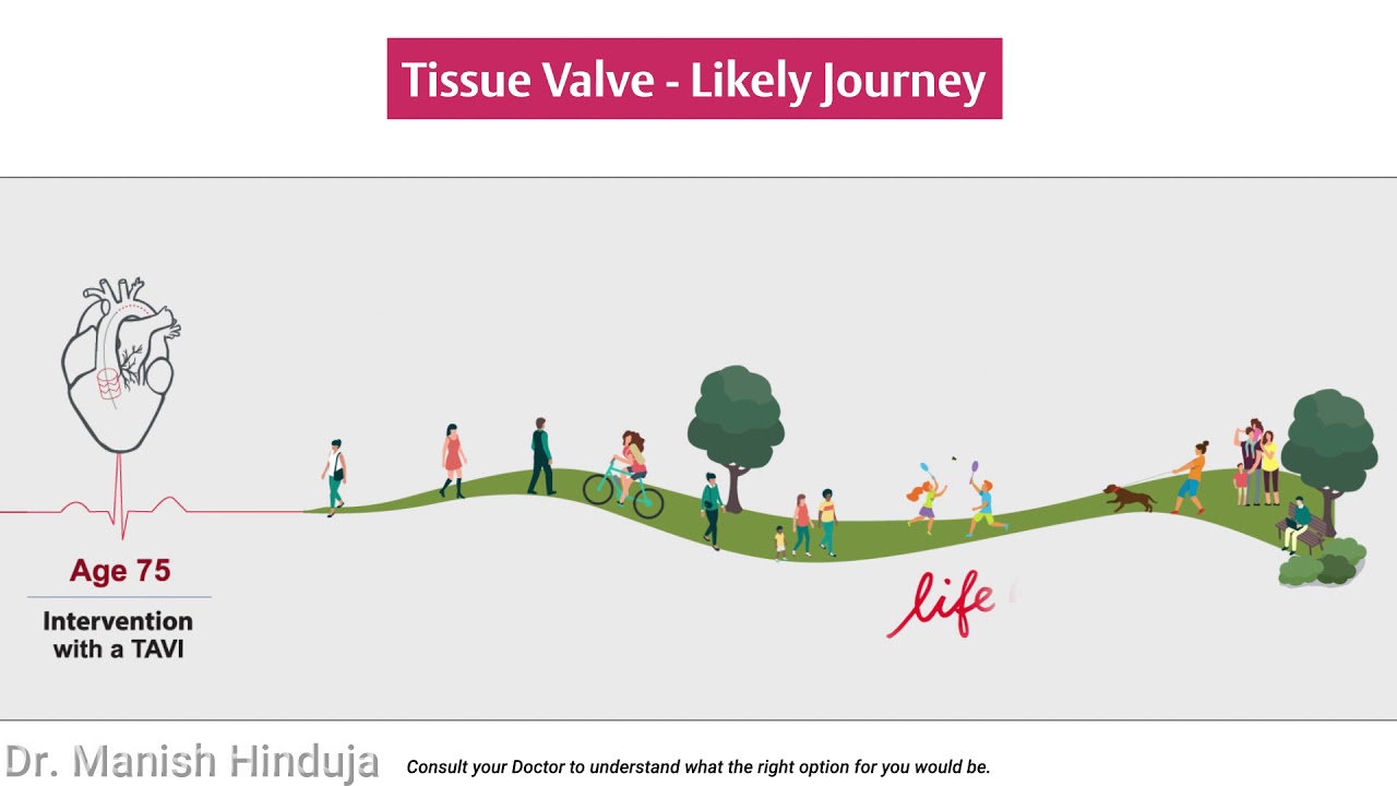 Options for Surgical Aortic Valve  | Dr Manish Hinduja - Cardiac Surgeon Mumbai