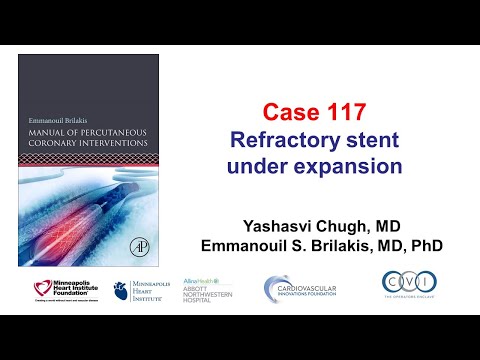 Case 117: PCI Manual - Refractory stent underexpansion