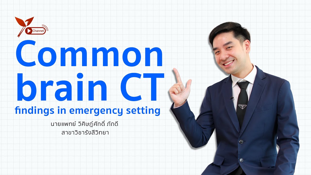 Common brain CT findings in emergency setting