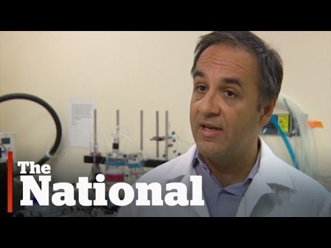 Fatty liver disease an epidemic few know about